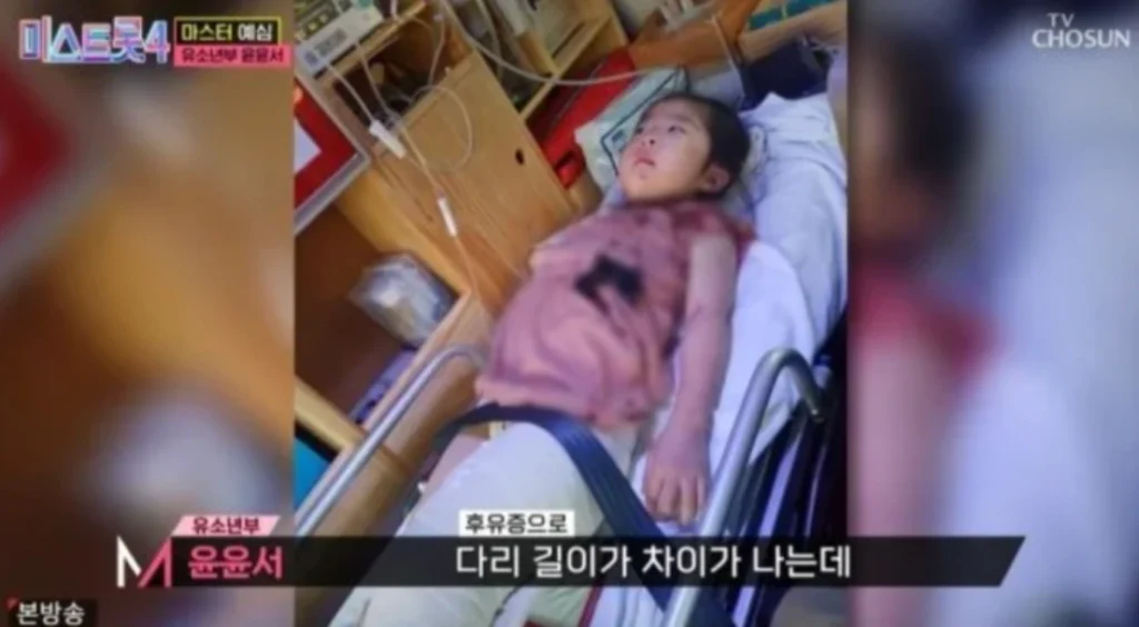 가수 윤윤서 미스트롯4 교통사고 치료 