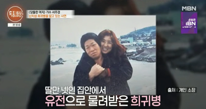 가수 서주경 희귀병 