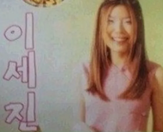 가수 린 성형 전